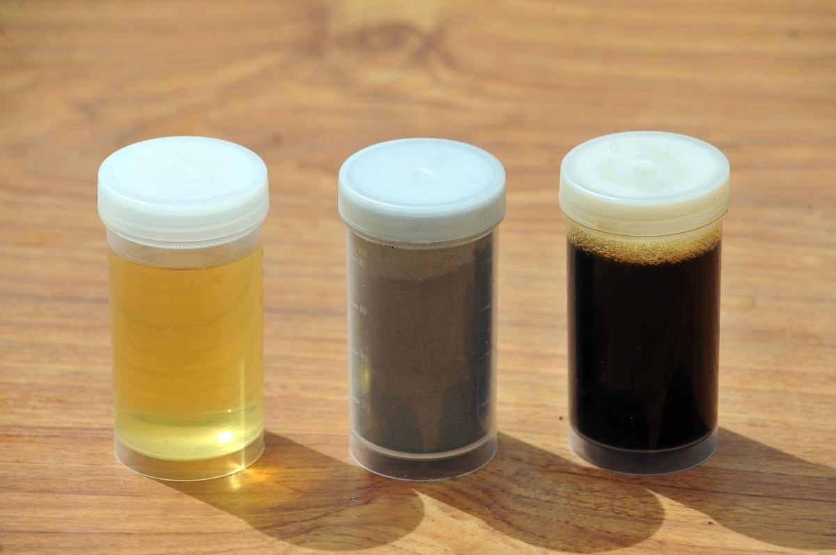 Fructo-oligosaccharides-protein-and-whey-extracted-from-juice.jpg